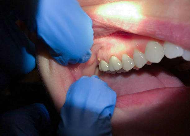 Best Emergency Dental Care for Trauma or Injury in Landrum, SC